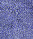 Abie Loy Kemarre - MB045415