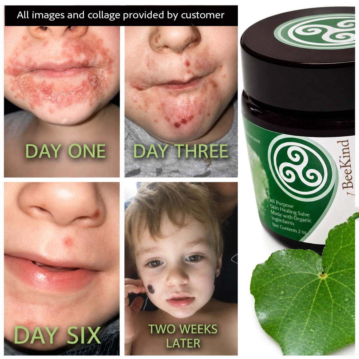 Bee Kind Kawakawa and Manuka Honey Skin Balm