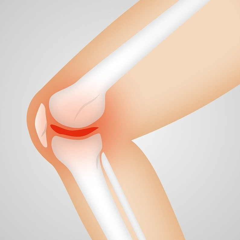 Knee Bursitis: How to Prevent This Common Knee Injury When Lifting Heavy Objects