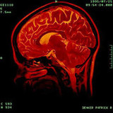 Scientists Identify Gene For Brain Injury Recovery