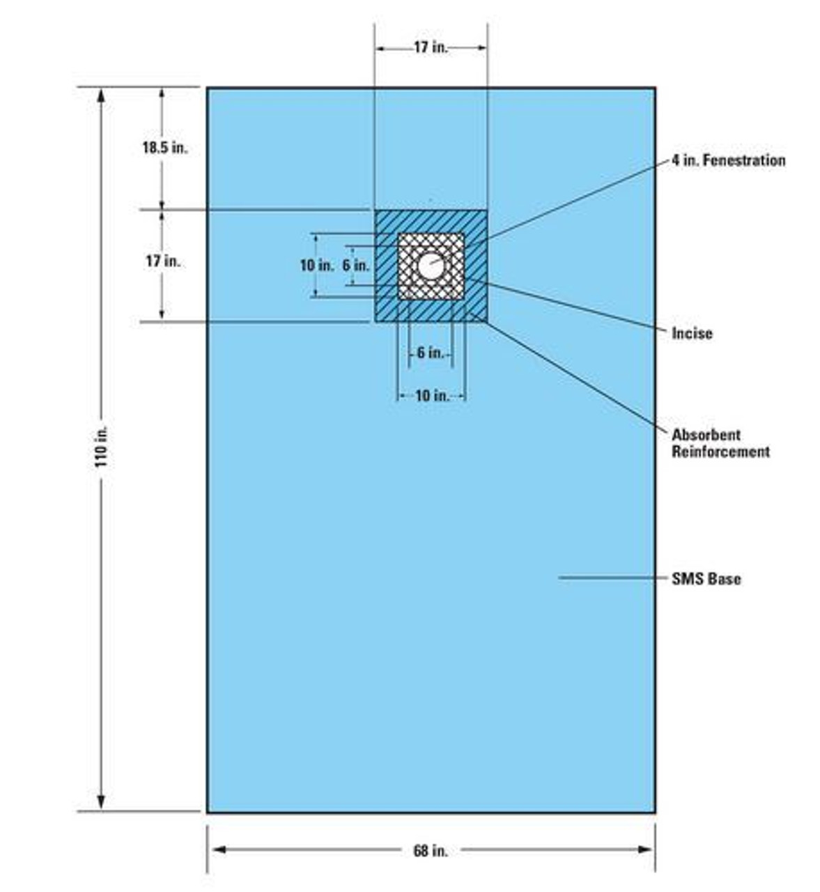 Halyard Kimguard CVC Full Body Drape, 68" x 110", Single Fenestration, Sterile, 20/cs