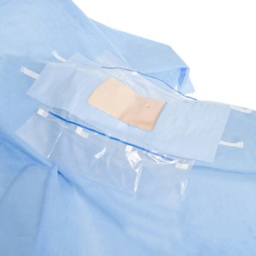 Halyard Laparoscopic/ Cholecystectomy Drape, 100" x 76" x 120", Clear Film Poly Pouch, Non-Sterile, Bulk, 18/cs
