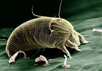 What are Dust Mites?