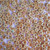 Matchy Matchy Sewing Club Caramel 1/2" Corozo Nut Buttons (Set of 8)