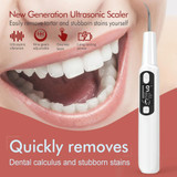 Ultrasonic Scaler Household Electric Dental Cleaner Tooth Scaling Machine(Standard Version)