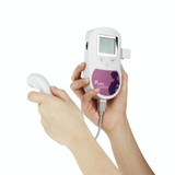 Baby Sound C   Fetal Doppler Prenatal Pocket Digital  Ultrasound Detector Angel Heartbeat Pregnant Doppler Prenatal Monitor(Rose Red)