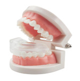 Orthodontic Appliance Silicone Simulation Braces Anti-molar Braces for Night(The third stage)