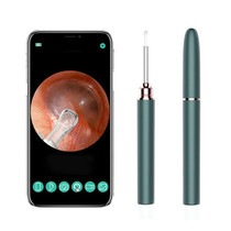 TES02 WIFI High-definition Intelligent Visual Ear Scoop(Ink Green)