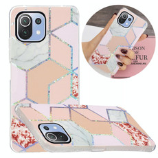 For Xiaomi Mi 11 Lite Electroplating TPU Protective Case(Pink Rhombus) For Xiaomi Mi 11 Lite Electroplating TPU Protective Case(Pink Rhombus)