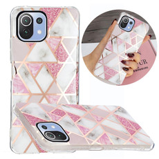 For Xiaomi Mi 11 Lite Electroplating TPU Protective Case(Pink White Rhombus) For Xiaomi Mi 11 Lite Electroplating TPU Protective Case(Pink White Rhombus)