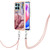 For Honor X6a Electroplating Marble Dual-side IMD Phone Case with Lanyard(Rose Red 014)