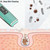 Ultrasonic Shoveling Machine Blackhead Beauty Instrument Iontophoresis Pore Cleaning Instrument(White)