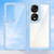 For Honor 70 Pro+ 5G Colorful Series Acrylic + TPU Phone Case(Blue)