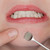 Stainless Steel Pore Cleaning Tool Blackhead Cleaner Beauty Makeup Remover Stainless Steel Pore Cleaning Tool Blackhead Cleaner Beauty Makeup Remover