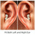 AN127 Invisible In-Ear Hearing Aid Sound Amplifier For The Elderly And Hearing Impaired(Blue Left Ear)