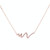 S925 Sterling Silver Necklace Women ECG Accessory Necklace(Rose Gold)