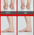 Flat Foot Orthopedic Insole Arch Collapse Support Pad Adult And Child Foot Valgus Orthosis L (Black)