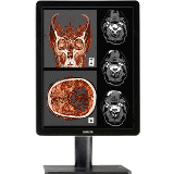 Barco K9602813 - Coronis Fusion Col Display 6MP MXRT7600