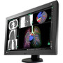 EIZO RX440-BK - 29.8 inch LED Color 1400:1 4MP 1536X2048 Medical Radiforce DVI