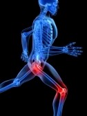 hipandkneeepain.jpg