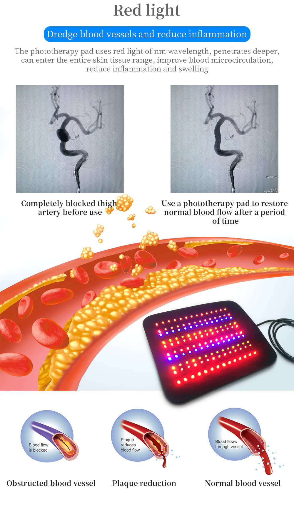 padbloodflow.jpg