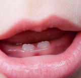 Teething Rash: Can teething cause a rash? Teething Rash: Can teething cause a rash?