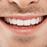 Don't Believe the Myths About Teeth Whitening