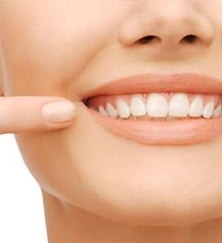 Teeth Whitening: How to whiten at home?