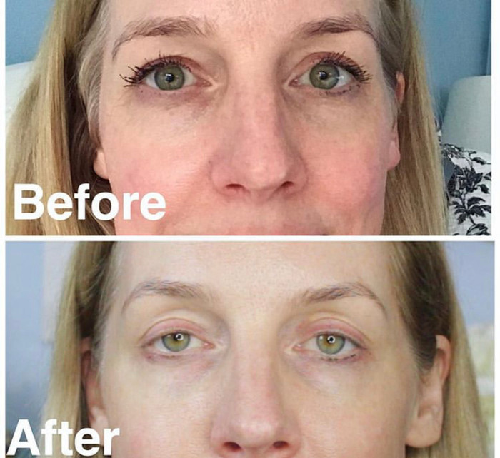 science serum tight eye