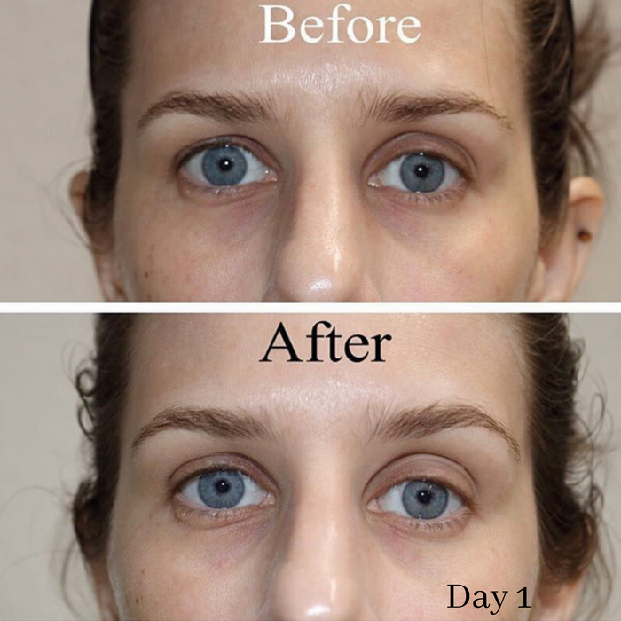 science serum tight eye