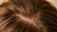 Biotine et cheveux : ce que dit la science | hairStore