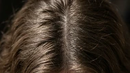 Cheveux gras : pourquoi ils regraissent si vite (et le mythe qui vous piège)