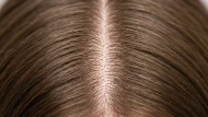 Cuir chevelu : sensible, gras ou qui démange | hairStore