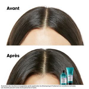 Shampooing Anti-Inconfort Scalp Advanced L'Oréal 300ml - hairStore.fr