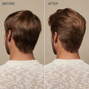 Scalp Care Regeniplex Après-Shampooing 300ml - hairStore.fr