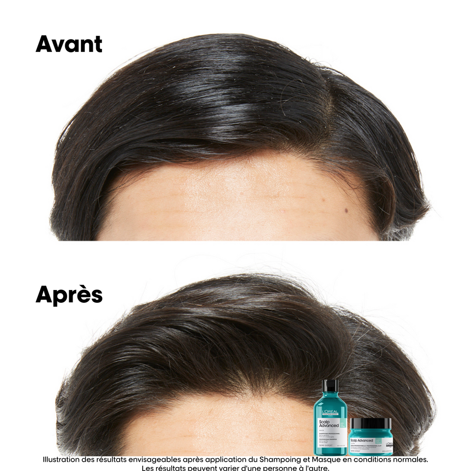 Shampooing Dermo-Purifiant Anti Gras Scalp Advanced L'Oréal 300ml - hairStore.fr