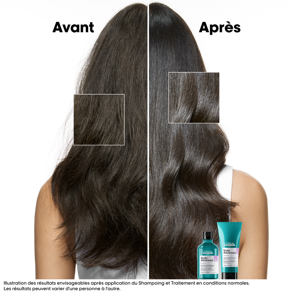 Shampooing Anti-Inconfort Scalp Advanced L'Oréal 300ml - hairStore.fr
