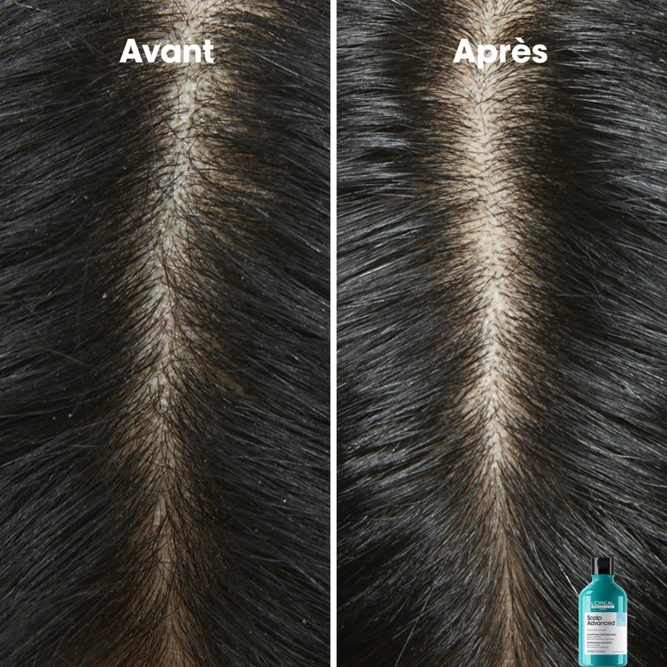 Shampooing Anti-Pelliculaire Scalp Advanced L'Oréal 500ml - hairStore.fr