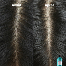 Shampooing Anti-Pelliculaire Scalp Advanced L'Oréal 500ml - hairStore.fr