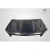 2008-2011 Mercedes C Class AMGT Carbon Fiber Hood - image 2