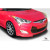 2012-2017 Hyundai Veloster Non Turbo N Design Front Lip Spoiler - 1 Piece (S) - image 6