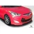 2012-2017 Hyundai Veloster N Design Front Lip - image 3