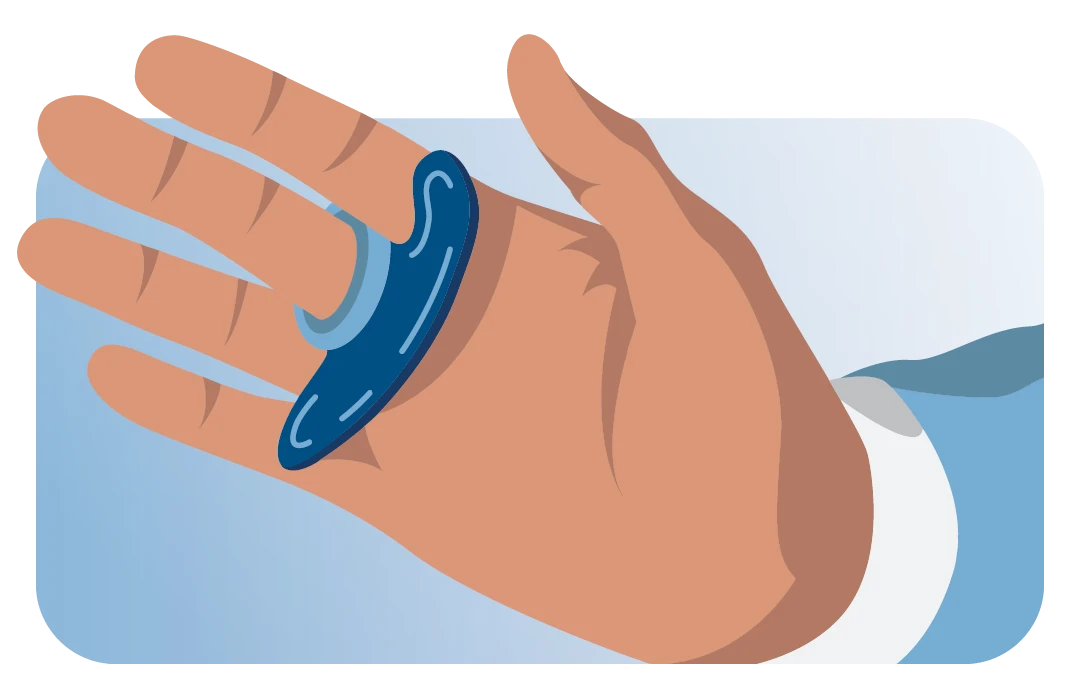 Place the ALVA mouth opener on your finger