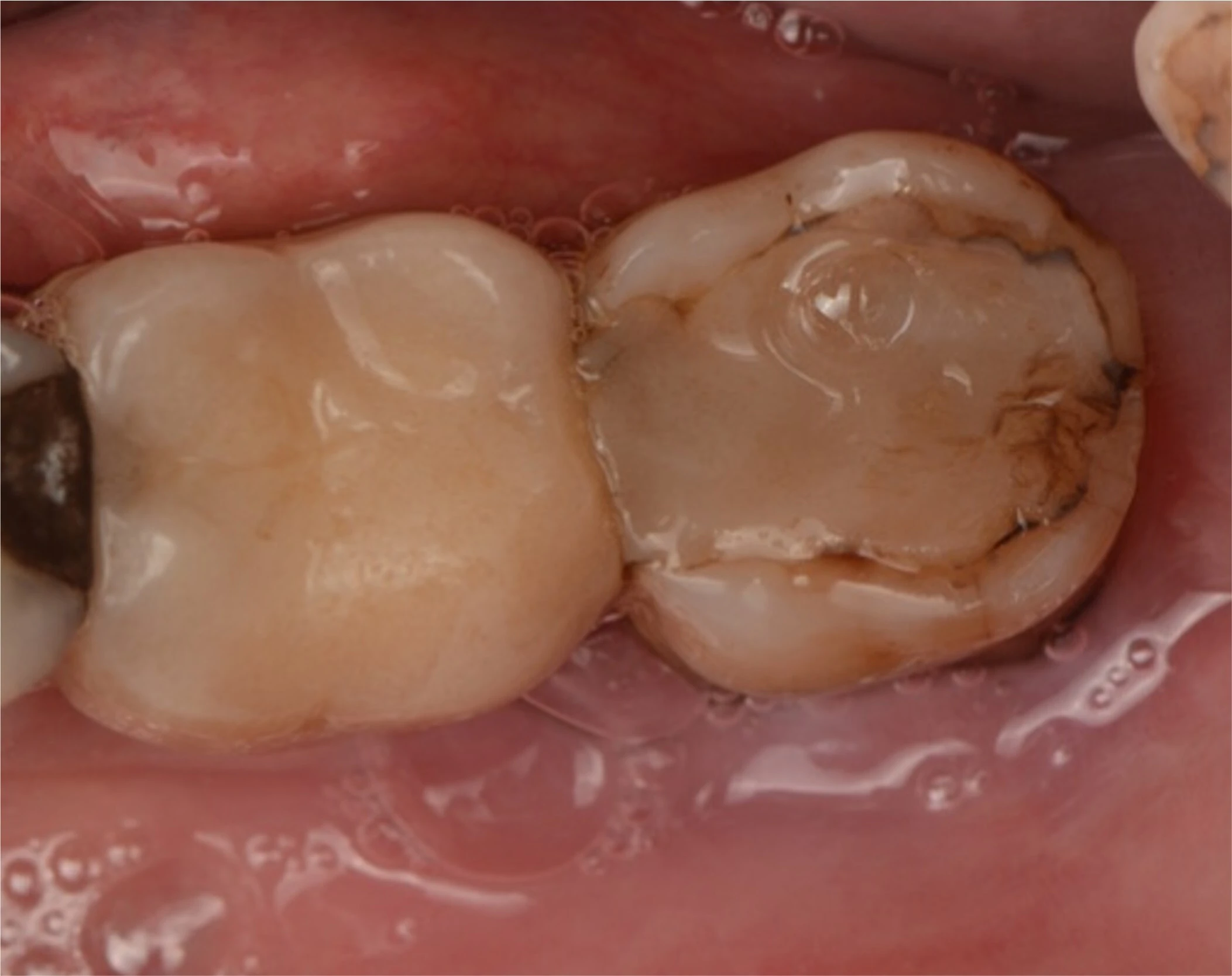 Surgery Image 1