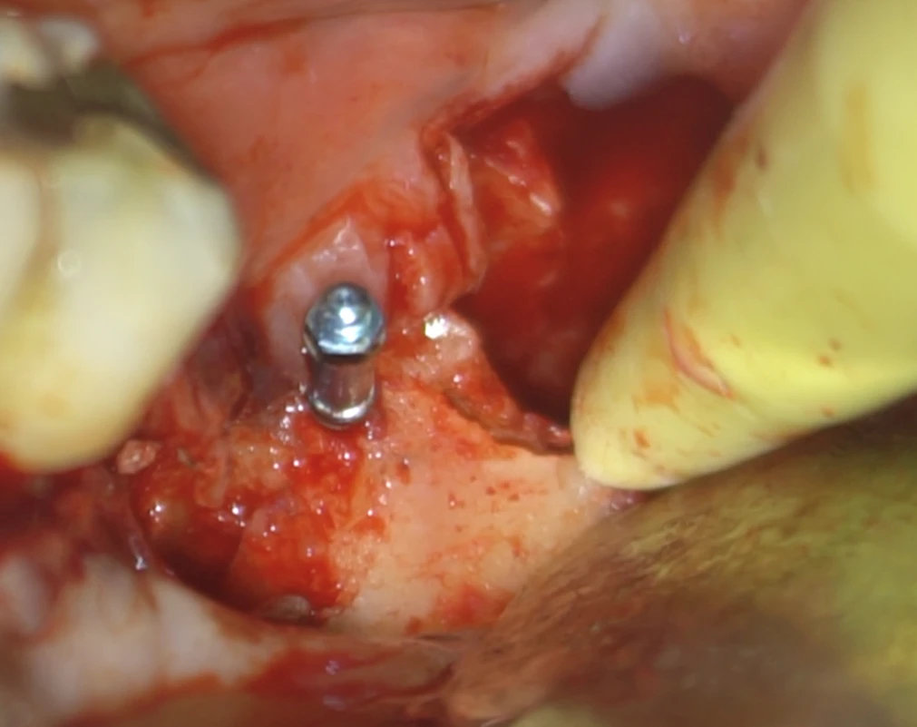 Surgery Image 2