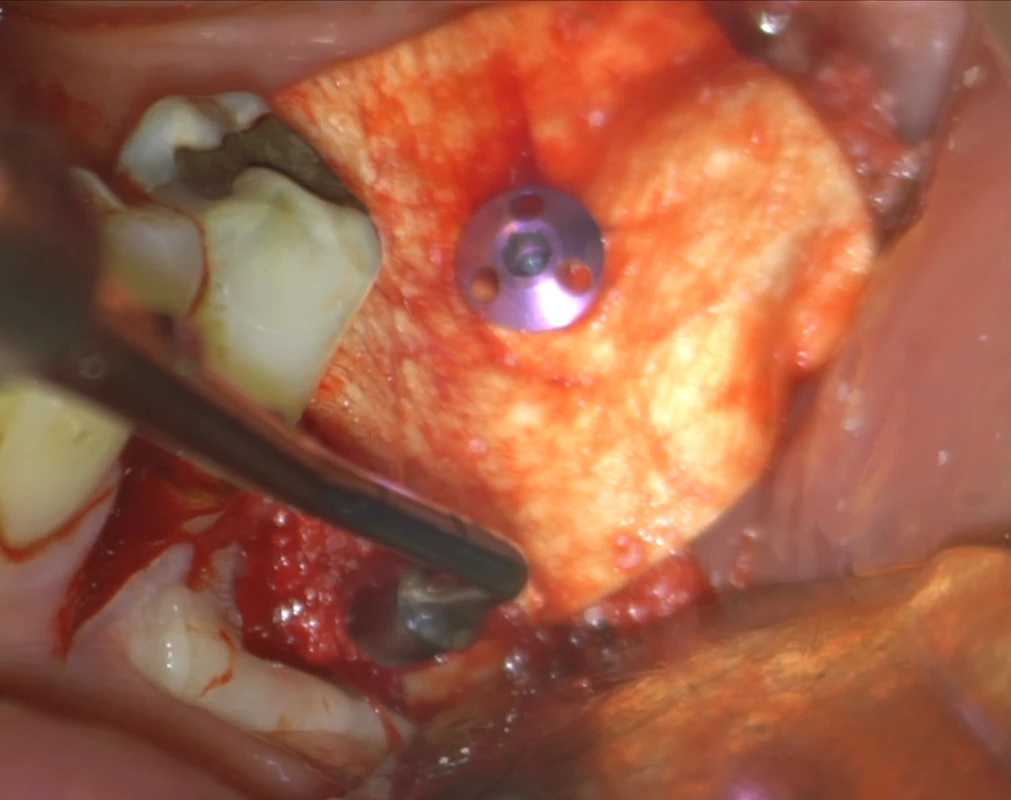 Surgery Image 3