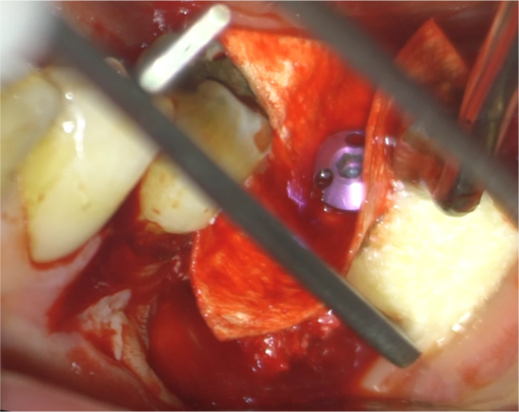 Surgery Image 4