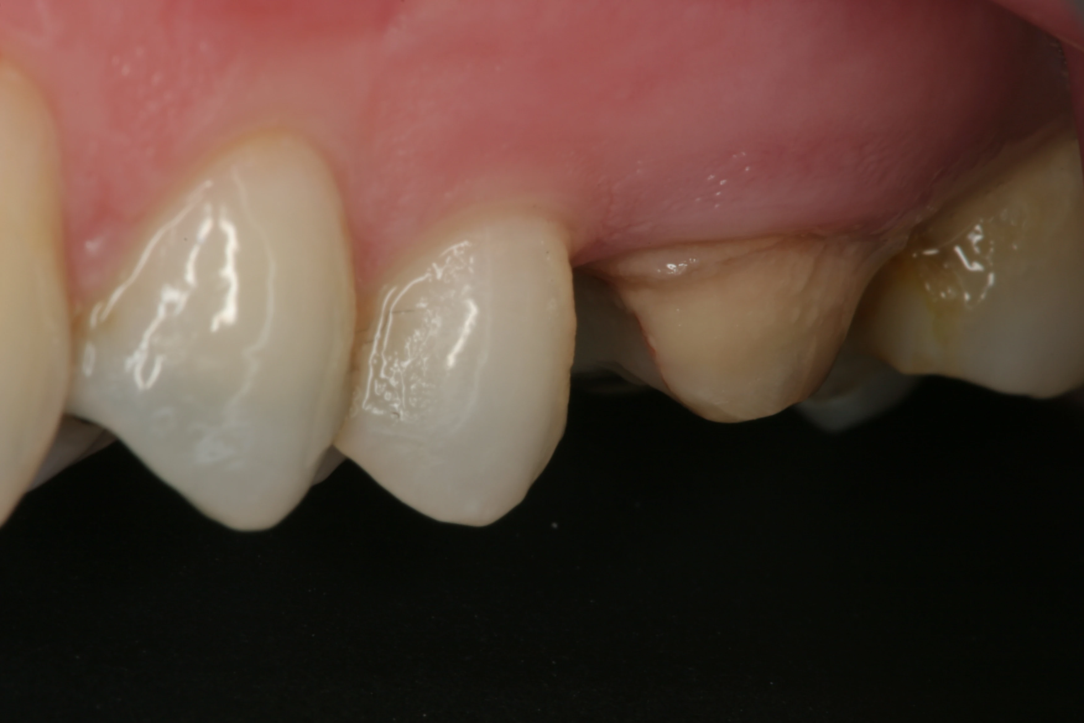Surgery Image 1