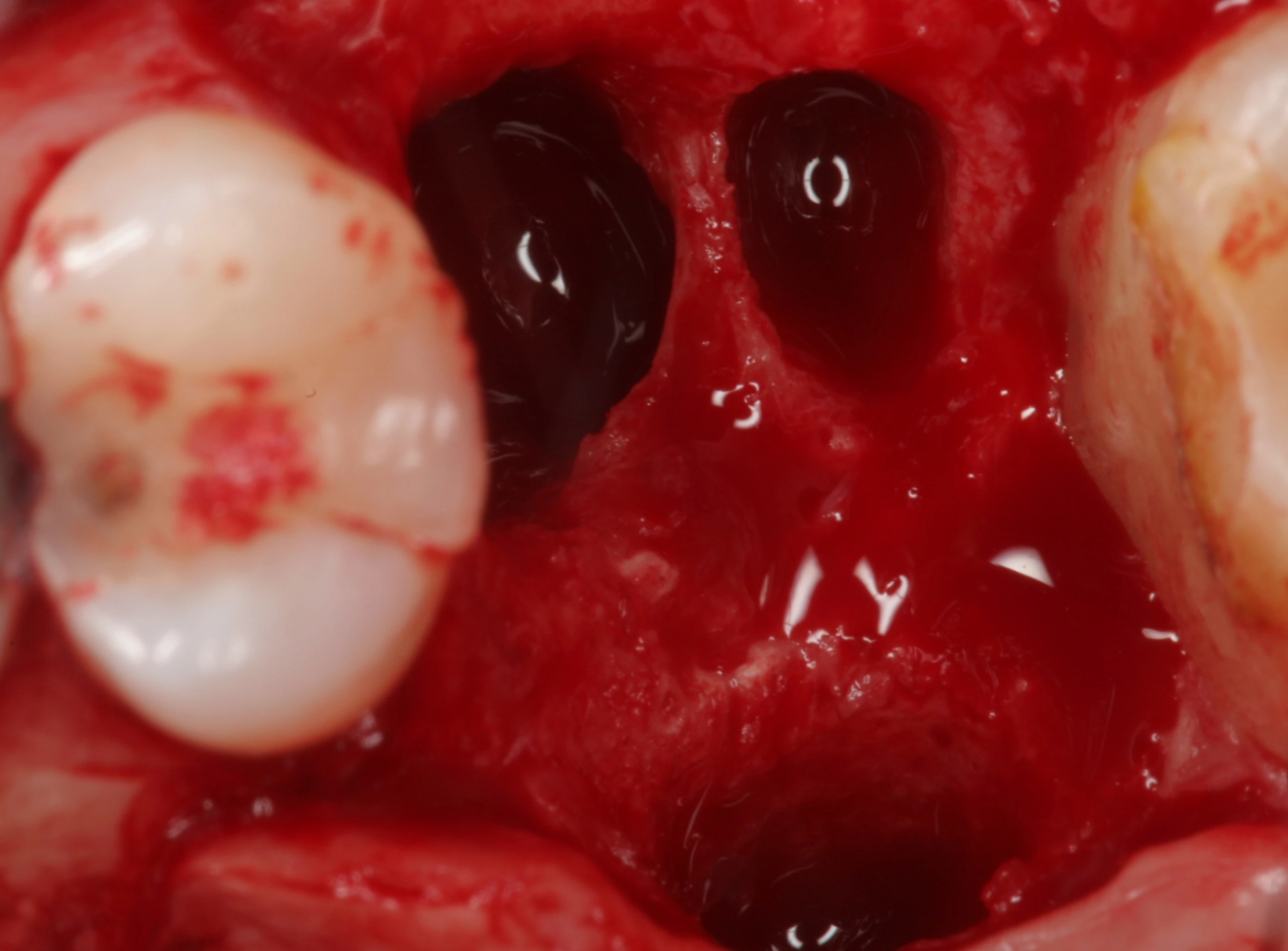 Surgery Image 2