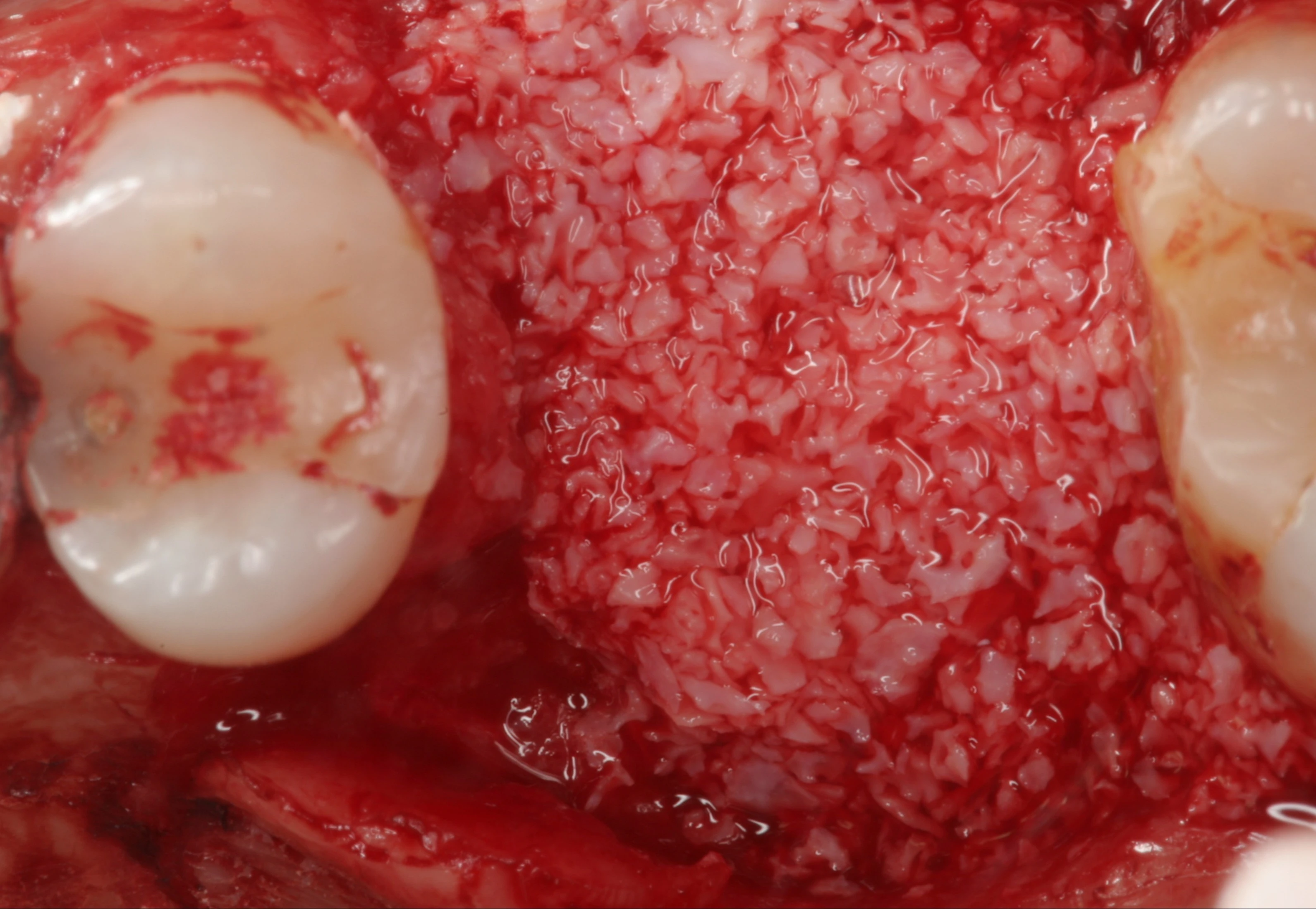 Surgery Image 3
